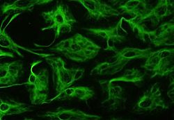 新研究发现：神经元支持整个身体的癌症生长