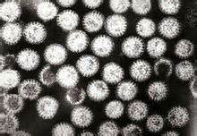 PLoS One:中科院上海巴斯德所金侠研究组发表丙型肝炎病毒T细胞反应研究成果