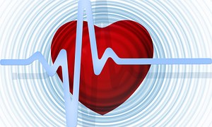 Heart：减肥手术可降低<font color="red">稳定型</font>心绞痛患者住院率！！！