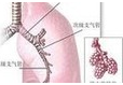 【盘点】近期非小细胞肺癌研究成果汇总