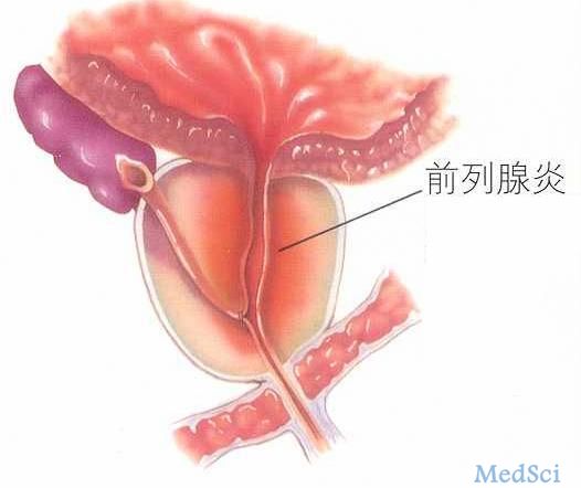 VPT或为低风险前列腺癌<font color="red">治疗</font>的新<font color="red">手段</font>