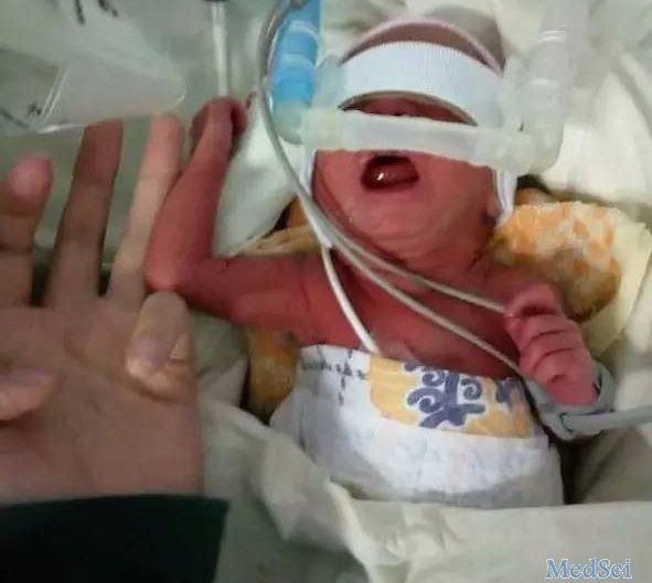 医护人员47天精心救治 贵州手掌大早产女婴奇迹存活