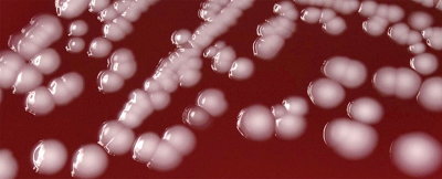WHO：12大耐药性细菌排名公布