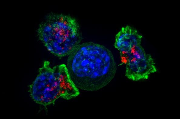 Cell：癌基因“遗传平衡”或会影响患者对癌症疗法的反应