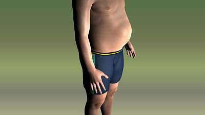 BMJ open：过度肥胖造成的心理阴影可能会影响身体活动能力