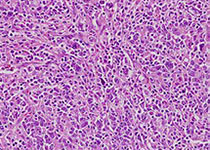 J Cell Biochem：<font color="red">乳腺癌</font>EMT调节的关键轴——GRHL2 / ZEB反馈环
