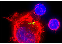Oncotarget：<font color="red">科学家</font>揭示疟原虫抗肝脏肿瘤免疫机制