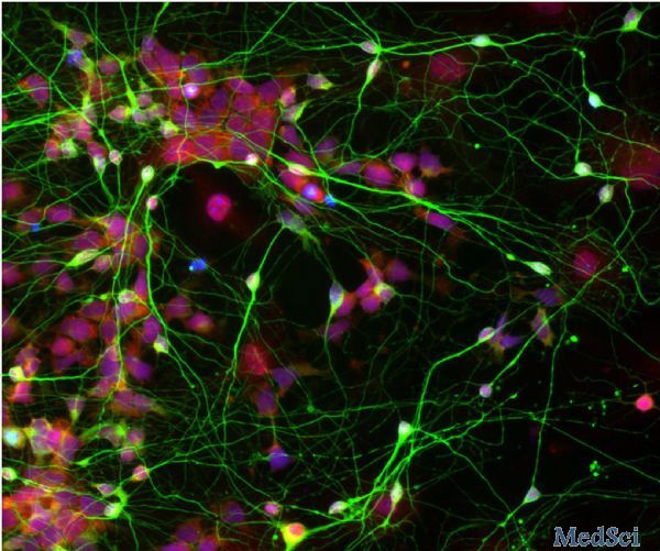 Stem Cell Reports：科学家利用小分子化合物将成人星形胶质细胞转变为神经细胞