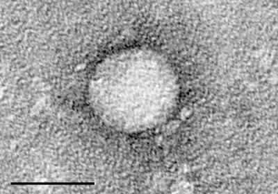 plos pathogen：HCV突变如何逃逸免疫系统的追捕？