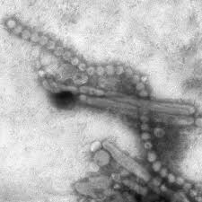 禽类染H7N9病毒可“一步”检测出