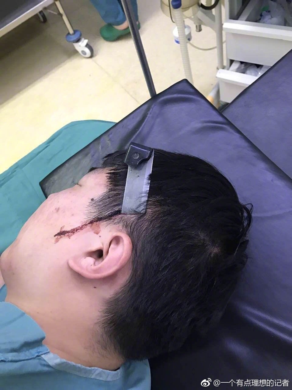 突发：一把13厘米的水果刀刺进了医生的头部