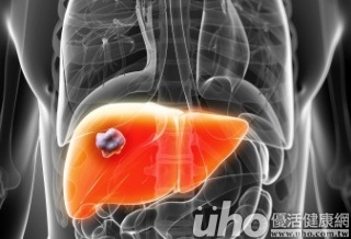 CLIN CANCER RES：使用PET辨别K19阳性肝<font color="red">细胞</font>癌<font color="red">肿瘤</font><font color="red">干细胞</font>