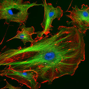 CANCER RES：纤维蛋白溶解酶可以增强肿瘤纳米治疗疗效