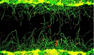 Neuron：植物用来对<font color="red">抗真菌</font>的<font color="red">分子</font>也能修复轴突: 或可用于治疗中枢神经系统损伤