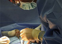 广东：世界首例3D胸腔镜辅助下介入治疗二尖瓣瓣周漏