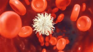 Leukemia：意大利科学家筛选出精准治疗白血病的潜在新药