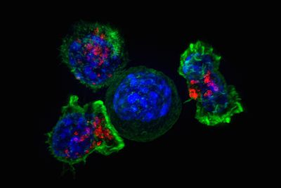 BRIEF FUNCT GENOMICS：新研究揭示表观遗传和代谢如何在癌症发育中发挥作用