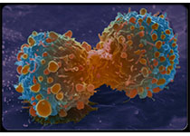 PNAS：两种蛋白质“为虎作伥”，帮助癌细胞扩散转移