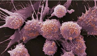 NEOPLASIA：癌细胞会隐身，传播癌症“肆无忌惮”