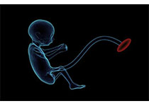 Cell：致胎儿缺陷的“<font color="red">染色体</font>秘密”揭开