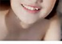J Dent：第一和第二前磨牙拔除对第三磨牙的影响：一项回顾性纵向研究