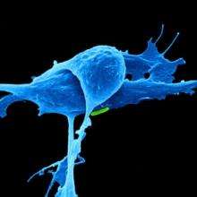 ACCR年会：联合用药提高PARP抑制剂在耐药卵巢癌中的应答