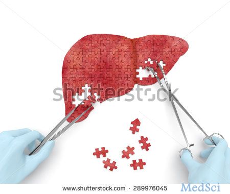Hepatology：靶向治疗<font color="red">线粒体</font><font color="red">丙酮酸</font>载体减轻小鼠非酒精性脂肪肝