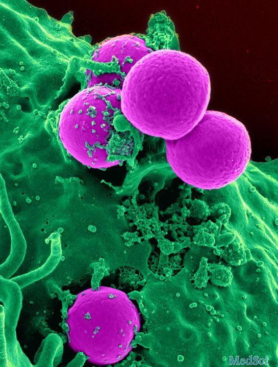 Oncoimmunology：浙江大学<font color="red">王</font>青青研究组揭示白细胞介素对肠炎相关肿瘤作用