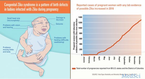 美国约 10% 染寨卡病毒孕妇面临缺陷宝宝问题
