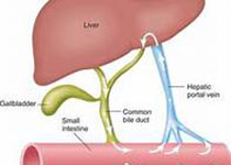 GUT：治疗肝脂肪和高脂血症的新方法！