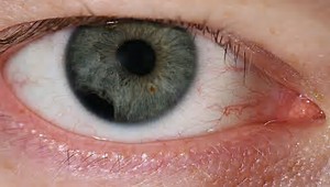 JAMA Ophthalmol：急性视锥区光感受器外节功能丧失病例