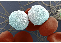 Cell Res：研究发现胰腺癌新克星
