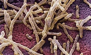Cell Host Microbe：衰老导致肠道菌群失衡促进慢性炎症