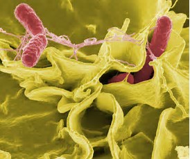 Immunity：肠道上皮细胞NLRC4蛋白的激活能够对抗沙门氏菌感染