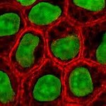 Cell：挑战原有观点：ESCRT样程序性细胞坏死