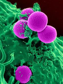 Exp Biol Med：新型药物递送系统靶向杀灭癌细胞，把化疗副作用降到最低！