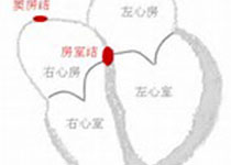 Heart：心房颤动对<font color="red">心尖</font><font color="red">肥厚</font>型心肌病病程的影响！