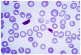 4月25日世界防治疟疾日 盘点疟疾<font color="red">研究</font>重大进展