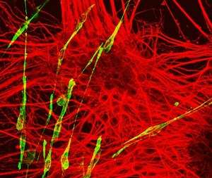 DEV CELL：新研究揭示了胚胎细胞如何产生脊髓，<font color="red">肌肉</font>和骨骼