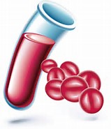 JAMA Inter Med：供体年龄及性别对输血<font color="red">者</font>的影响