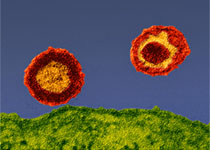PloS Pathogens：研究模拟HIV-<font color="red">抗体</font>相互作用，优化HIV治疗！