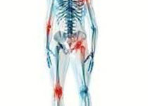 Arthritis Care Res：膝盖嘎吱作响，一定不要忽视！