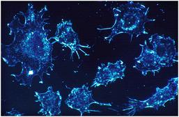 Nat Nanotechnol：开发出新的抗癌<font color="red">纳米</font>颗粒，有望长期阻止癌症复发