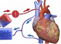 Ann Surg：<font color="red">非</font><font color="red">心脏</font>手术是否会发生心肌损伤呢？