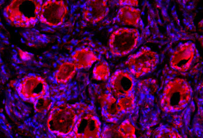 Cell Rep：诱导肺癌复发的“根源”被曝光，彻底解决化疗耐药性问题！