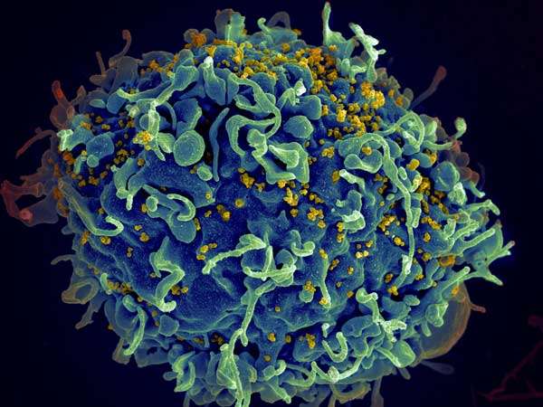 Cell Chem Bio：突破—HIV疫苗将会提前问世，从根本上解决艾滋病问题