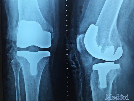 Adv Mater：核酸适配体功能化的双面材料应用于膝关节修复