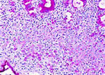 MOL CANCER THER：<font color="red">非</font>小细胞肺癌细胞对EGFR -酪氨酸激酶抑制剂埃罗替尼的<font color="red">敏感性</font>