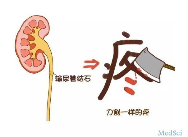 【病例】仁济医院经典病例-输尿管结石1例