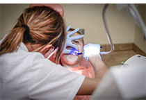 J Dent Res：快速细菌检测在牙髓治疗过程中的应用